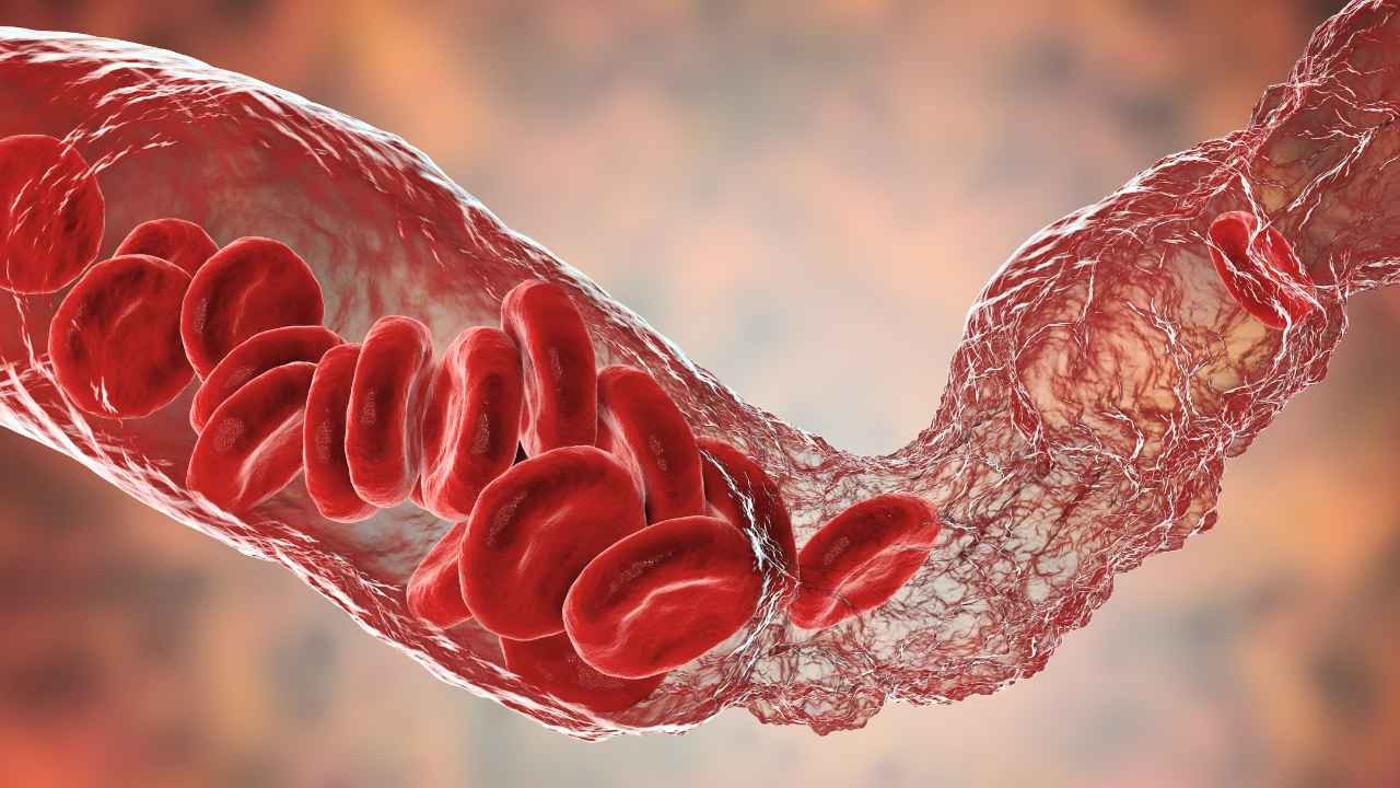 Vasoconstriction, clot formation in blood vessel. Image Credit: Adobe Stock Images/Dr_Microbe