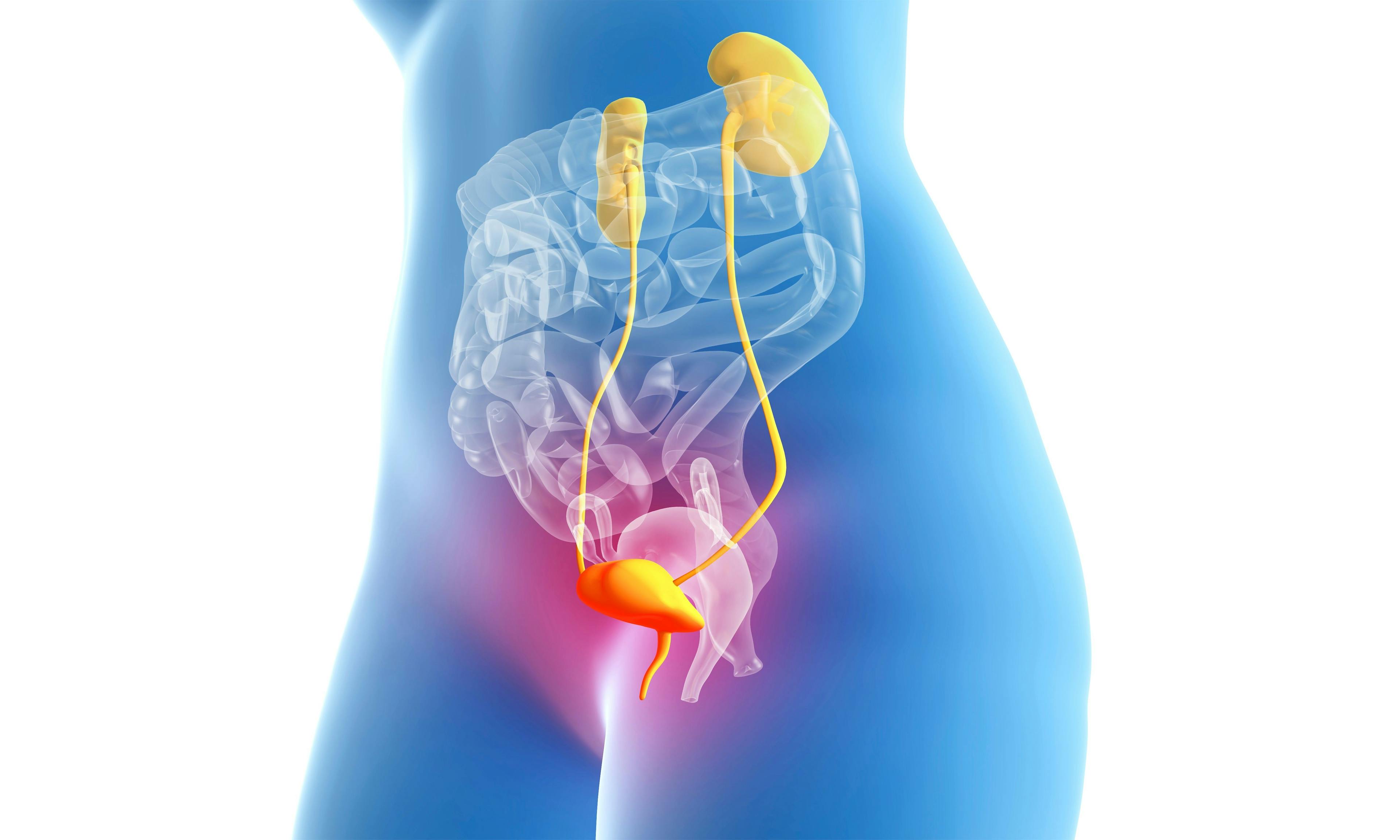 Image credit: TuMeggy | stock.adobe.com. Cystitis, urinary tract infection and inflammation of the bladder, female anatomy 3d illustration on white background